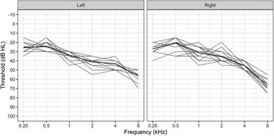 Comparing outcomes of ultra-low-cost hearing aids to programmable, refurbished hearing aids for adults with high frequency hearing loss in Malawi: a feasibility study